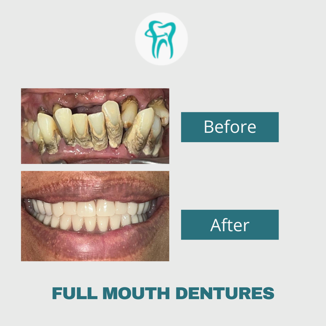 Hi Dentist_Before After